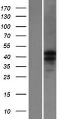 Western Blot: CATSPER3 Overexpression Lysate [NBP2-04993]