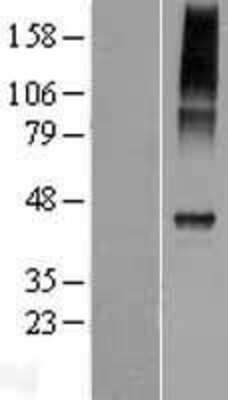 Western Blot: CATSPER4 Overexpression Lysate [NBP2-04738]