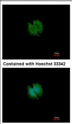 Immunocytochemistry/ Immunofluorescence: CATSPERB Antibody [NBP2-15728]