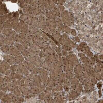 Immunohistochemistry-Paraffin: CATSPERB Antibody [NBP1-90729]