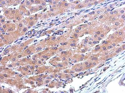 Immunohistochemistry-Paraffin: CATSPERB Antibody [NBP2-15728]