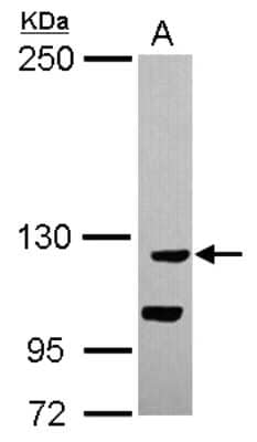 Western Blot: CATSPERB Antibody [NBP2-15728]