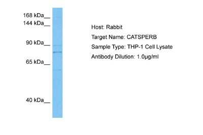 Western Blot: CATSPERB Antibody [NBP2-84593]