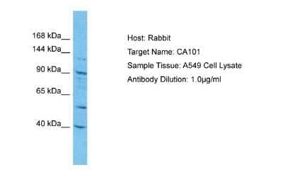 Western Blot: CATSPERE Antibody [NBP2-37849]