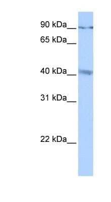 Western Blot: CATSPERG Antibody [NBP1-91342]