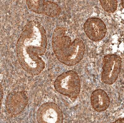 Immunohistochemistry-Paraffin: CBARA1 Antibody [NBP1-86663]
