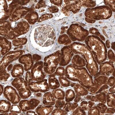 Immunohistochemistry-Paraffin: CBARA1 Antibody [NBP1-86663]