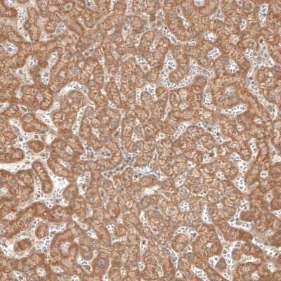 Immunohistochemistry-Paraffin: CBARA1 Antibody [NBP1-86663]