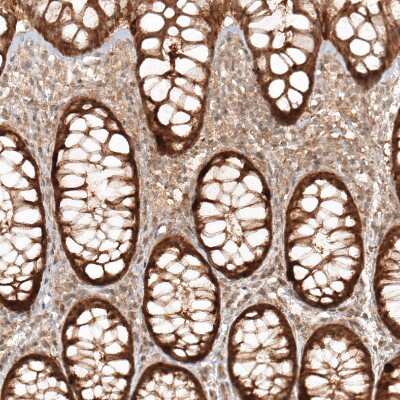 Immunohistochemistry-Paraffin: CBARA1 Antibody [NBP1-86663]