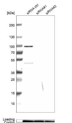 Western Blot: CBARA1 Antibody [NBP2-58173]