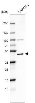 Western Blot: CBARA1 Antibody [NBP2-58173]