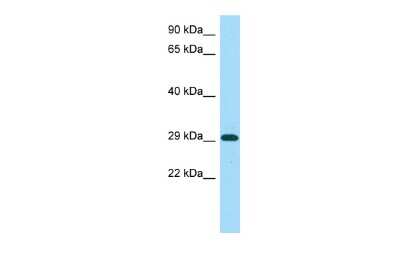 Western Blot: CBARA1 Antibody [NBP2-87128]