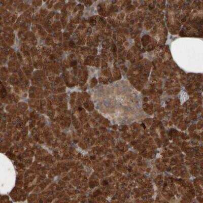 Immunohistochemistry: CBCP3 Antibody [NBP1-91753]