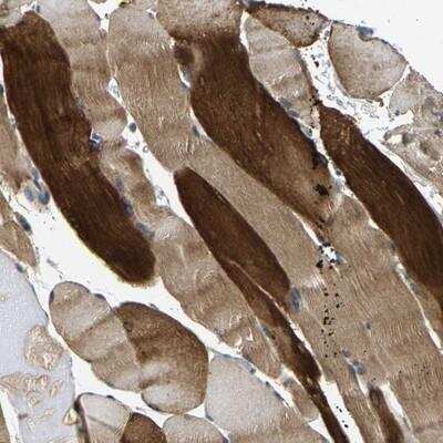 Immunohistochemistry-Paraffin: CBCP3 Antibody [NBP1-91752]