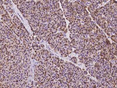 Immunohistochemistry-Paraffin: CBCP3 Antibody [NBP2-98584]