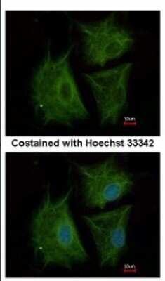 Immunocytochemistry/ Immunofluorescence: CBCP6 Antibody [NBP2-15729]