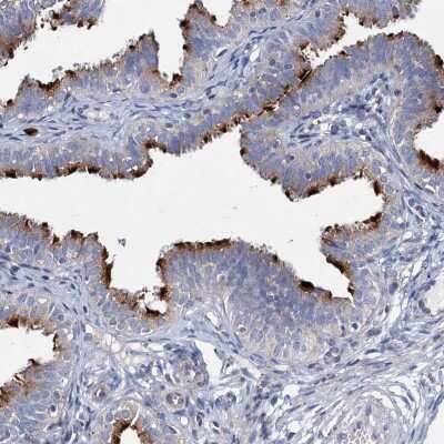 Immunohistochemistry-Paraffin: CBCP6 Antibody [NBP1-91754]