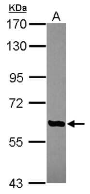 Western Blot: CBCP6 Antibody [NBP2-15729]