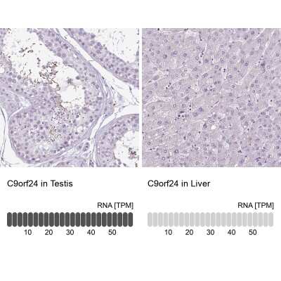 Immunohistochemistry-Paraffin: CBE1 Antibody [NBP2-14425]