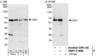 Western Blot: CBF1-interacting corepressor Antibody [NBP1-71896]