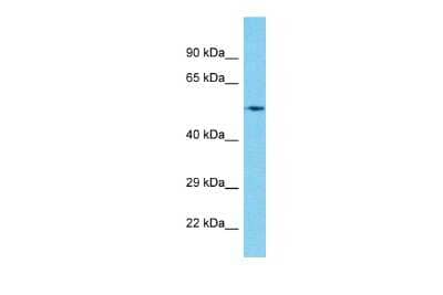 Western Blot: CBF1-interacting corepressor Antibody [NBP2-87131]