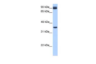 Western Blot: CBF1-interacting corepressor Antibody [NBP2-87132]