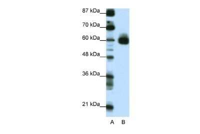 Western Blot: CBF1-interacting corepressor Antibody [NBP2-87133]