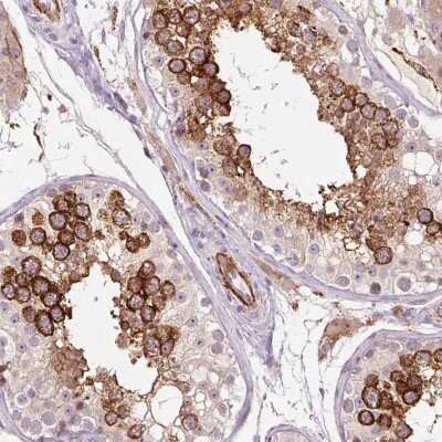 Immunohistochemistry: CBF2 Antibody [NBP2-47525]