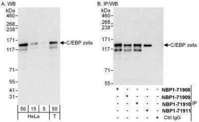 Western Blot: CBF2 Antibody [NBP1-71908]