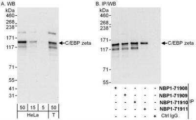 Western Blot: CBF2 Antibody [NBP1-71909]