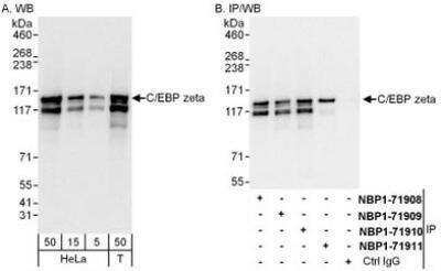 Western Blot: CBF2 Antibody [NBP1-71910]