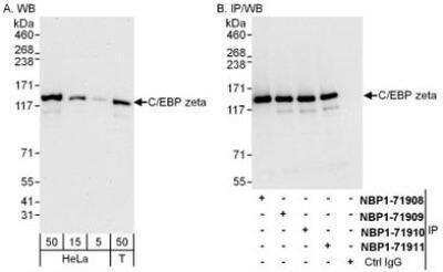 Western Blot: CBF2 Antibody [NBP1-71911]