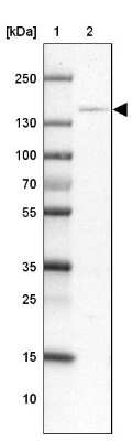 Western Blot: CBF2 Antibody [NBP2-47525]