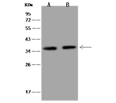 Western Blot: CBF2 Antibody [NBP2-97347]