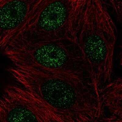 Immunocytochemistry/ Immunofluorescence: CBFA2T3 Antibody [NBP2-56012]