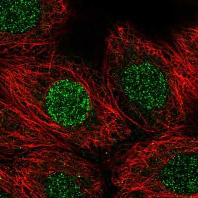 Immunocytochemistry/ Immunofluorescence: CBFA2T3 Antibody [NBP2-56206]