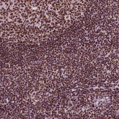 Immunohistochemistry-Paraffin: CBFA2T3 Antibody [NBP2-57636]