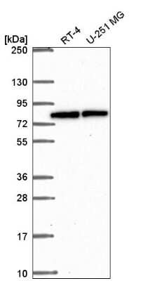 Western Blot: CBFA2T3 Antibody [NBP2-57636]