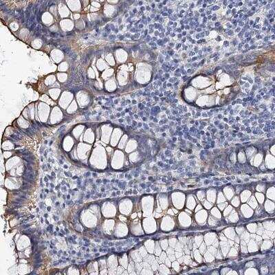 Immunohistochemistry-Paraffin: CBFB Antibody [NBP1-87300]