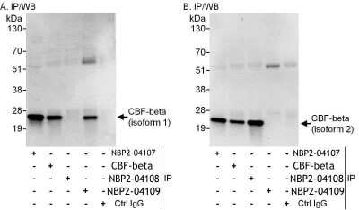 Immunoprecipitation: CBFB Antibody [NBP2-04107]