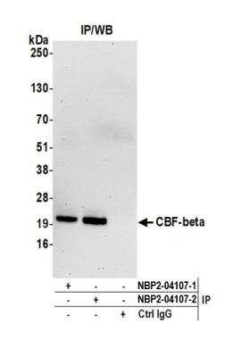 Immunoprecipitation: CBFB Antibody [NBP2-04107]