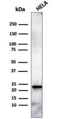 Western Blot: CBFB Antibody (PCRP-CBFB-1E6) [NBP3-13808]