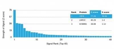 Protein Array: CBFB Antibody (PCRP-CBFB-1F6) - Azide and BSA Free [NBP3-14058]