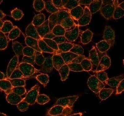 Immunocytochemistry/ Immunofluorescence: CBFB Antibody (PCRP-CBFB-1F6) [NBP3-13807]