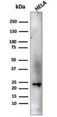 Western Blot: CBFB Antibody (PCRP-CBFB-1F6) [NBP3-13807]