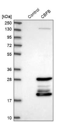 Western Blot: CBFB Antibody [NBP1-87300]