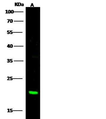 Western Blot: CBFB Antibody [NBP3-00328]