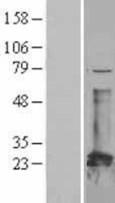 Western Blot: CBFB Overexpression Lysate [NBL1-08735]