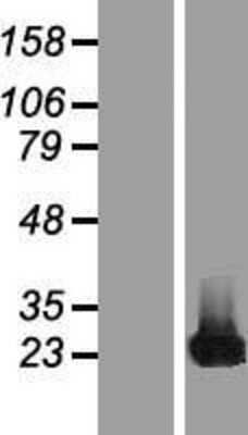 Western Blot: CBFB Overexpression Lysate [NBP2-06393]