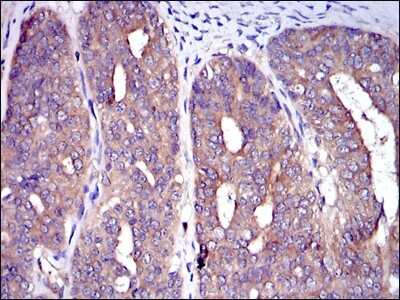 Immunohistochemistry-Paraffin: CBL Antibody (3B12) - BSA Free [NBP2-37574]